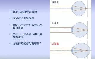 配镜处方什么意思，配镜处方