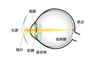 视力矫正是什么原理，视力矫正是什么意思