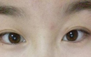 大直径美瞳多少厘米，大直径美瞳多少厘米正常